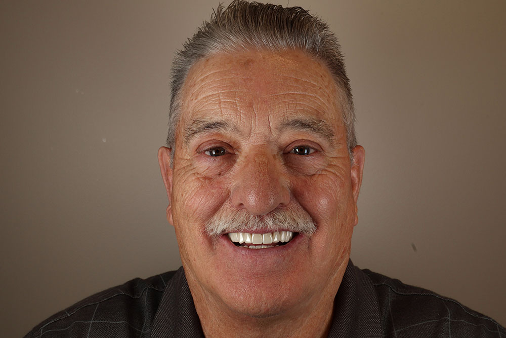 After image alt