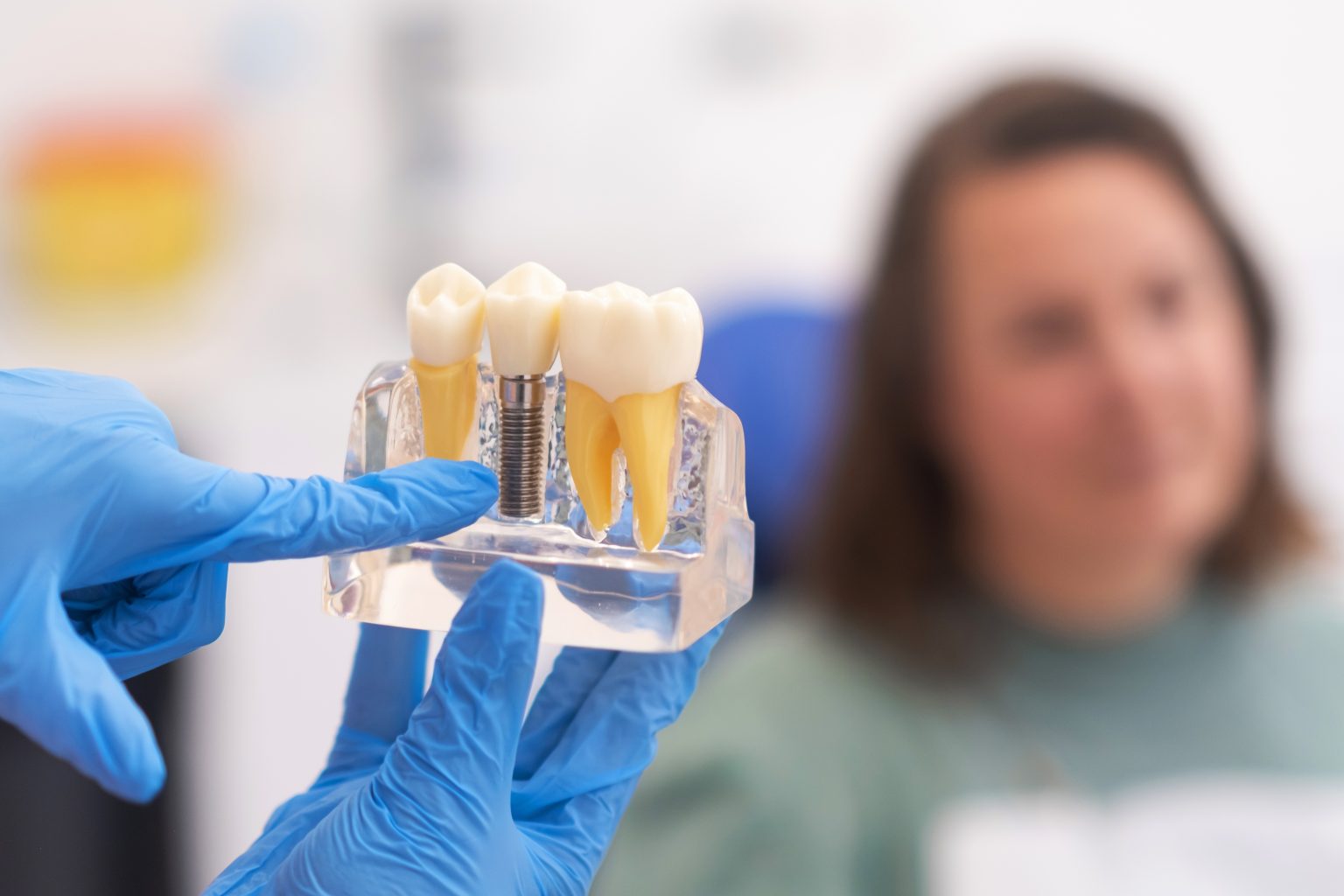 dental implants lafayette